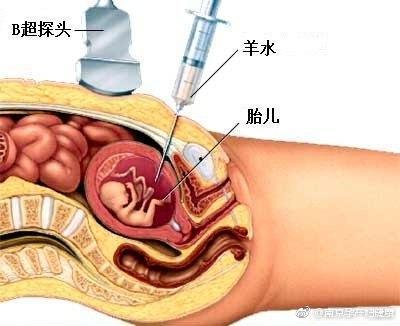 羊水穿刺后可以吃瓜,这些食物可以放心享用